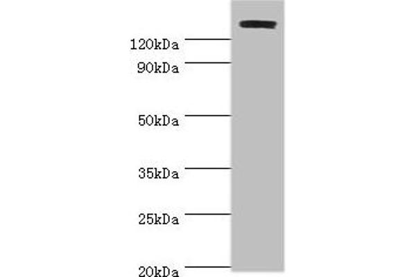 TP53BP2 anticorps  (AA 360-600)