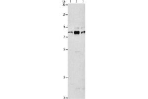 Western Blotting (WB) image for anti-rho Guanine Nucleotide Exchange Factor (GEF) 7 (ARHGEF7) antibody (ABIN2429254) (ARHGEF7 anticorps)