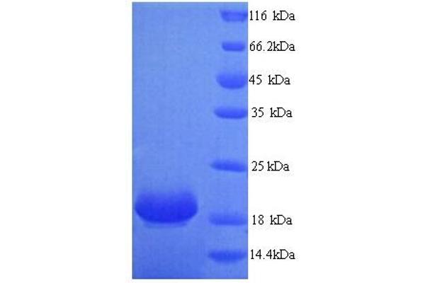 LYPD6 Protein (AA 23-171) (His tag)