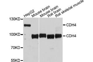 Western blot analysis of extracts of various cell lines, using CDH4 antibody (ABIN5997416) at 1/1000 dilution. (Cadherin 4 anticorps)