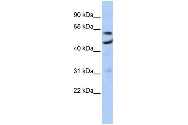 CNOT6 anticorps  (N-Term)