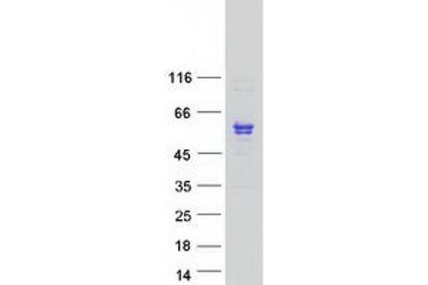 SMPDL3B Protein (Transcript Variant 2) (Myc-DYKDDDDK Tag)