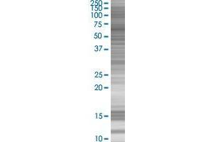 MSL3L1 transfected lysate. (MSL3L1 293T Cell Transient Overexpression Lysate(Denatured))