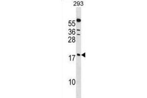 Western Blotting (WB) image for anti-Peptidylprolyl Isomerase (Cyclophilin)-Like 1 (PPIL1) antibody (ABIN2998971) (PPIL1 anticorps)