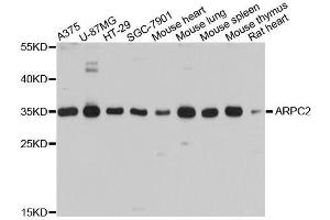 Western blot analysis of extracts of various cell lines, using ARPC2 antibody. (ARPC2 anticorps  (AA 1-300))