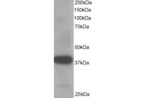 Western Blotting (WB) image for anti-Aldo-Keto Reductase Family 1, Member B1 (Aldose Reductase) (AKR1B1) (C-Term) antibody (ABIN2465387) (AKR1B1 anticorps  (C-Term))