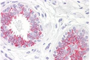 Anti-MAP2K1 / MEK1 antibody IHC staining of human breast. (MEK1 anticorps  (AA 252-301))