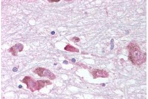 Human Brain, Substantia Nigra (formalin-fixed, paraffin-embedded) stained with MCHR1 antibody ABIN213354 at 10-18 ug/ml followed by biotinylated goat anti-rabbit IgG secondary antibody ABIN481713, alkaline phosphatase-streptavidin and chromogen. (MCHR1 anticorps  (C-Term))