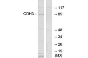 Western blot analysis of extracts from K562 cells, using CDH3 Antibody. (P-Cadherin anticorps  (AA 51-100))