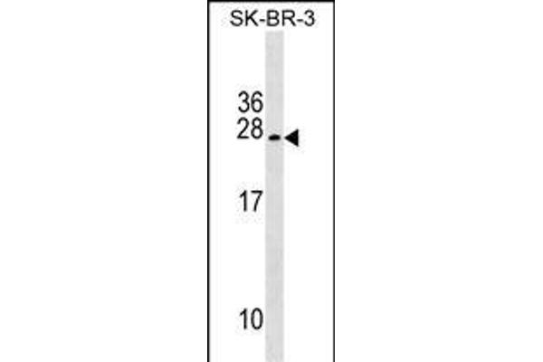 TUSC5 anticorps  (AA 78-104)