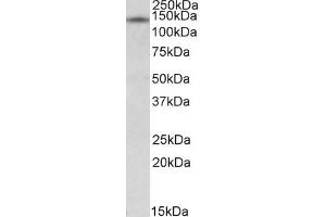 Western Blotting (WB) image for anti-Nuclear Receptor Interacting Protein 1 (NRIP1) antibody (ABIN5881688) (NRIP1 anticorps)