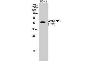 Western Blotting (WB) image for anti-Jun Proto-Oncogene (JUN) (acLys271) antibody (ABIN3178880) (C-JUN anticorps  (acLys271))