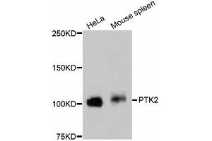 Western blot analysis of extracts of various cell lines, using PTK2 antibody (ABIN5997089). (FAK anticorps)