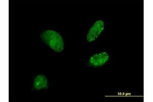 Immunofluorescence of purified MaxPab antibody to DCTN3 on HeLa cell. (DCTN3 anticorps  (AA 1-176))