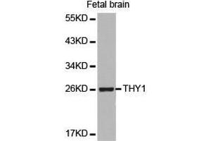 Western Blotting (WB) image for anti-CD90 (THY1) antibody (ABIN1875094) (CD90 anticorps)