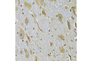 Immunohistochemistry of paraffin-embedded mouse brain using ITGA2 Antibody (ABIN5974459) at dilution of 1/100 (40x lens). (ITGA2 anticorps)