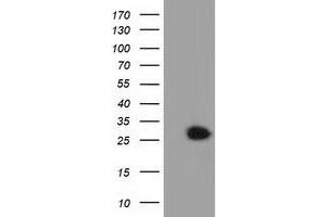 HEK293T cells were transfected with the pCMV6-ENTRY control (Left lane) or pCMV6-ENTRY GSTT2 (Right lane) cDNA for 48 hrs and lysed. (GSTT2 anticorps)