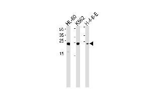 Western blot analysis in HL-60,K562,H-4-II-E cell line lysates (35ug/lane). (HMGB2 anticorps  (AA 92-118))