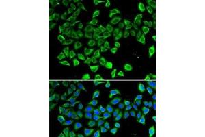 Immunofluorescence analysis of A-549 cells using LCN2 Polyclonal Antibody (Lipocalin 2 anticorps)