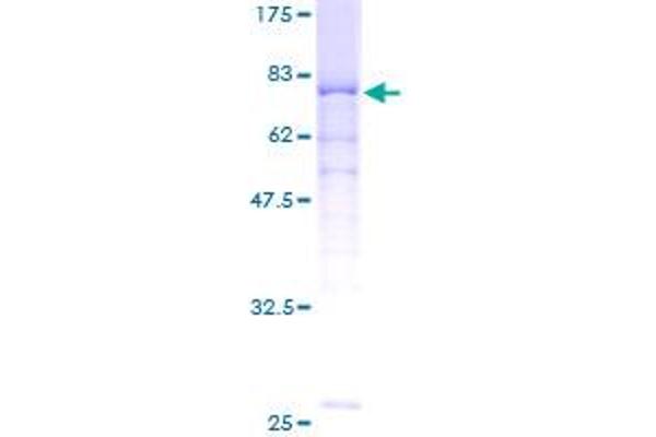 PPP2R2A Protein (AA 1-447) (GST tag)