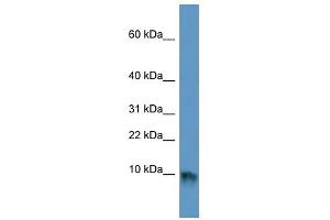 EGF antibody used at 1 ug/ml to detect target protein. (EGF anticorps)