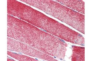 Anti-MAP3K10 / MLK2 antibody IHC staining of human skeletal muscle. (MAP3K10 anticorps  (AA 110-138))