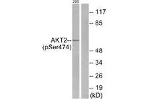 Western Blotting (WB) image for anti-V-Akt Murine Thymoma Viral Oncogene Homolog 2 (AKT2) (pSer474) antibody (ABIN2888354) (AKT2 anticorps  (pSer474))