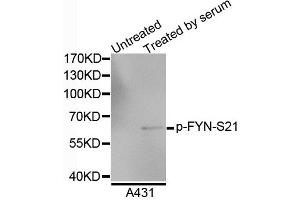 Western blot analysis of extracts of A4731 cells, using Phospho-FYN-S21 antibody. (FYN anticorps  (pSer21))