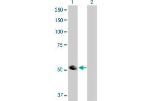 Western Blot analysis of TRIP6 expression in transfected 293T cell line by TRIP6 MaxPab polyclonal antibody. (TRIP6 anticorps  (AA 1-476))