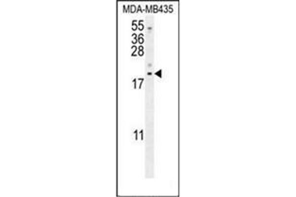 LYRM4 anticorps  (Middle Region)