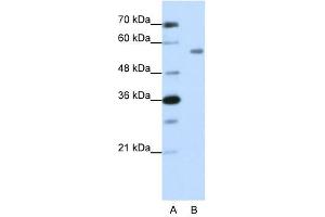 ZNF497 anticorps  (N-Term)