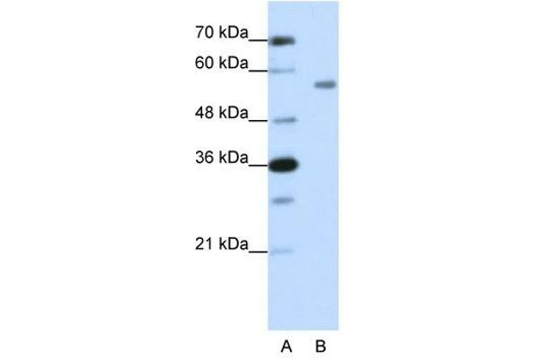 ZNF497 anticorps  (N-Term)