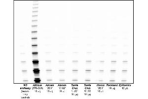 Antibodies and their commercial vendor are described, based on immunoprecipitation of telomerase from HEK-293 tumour cell lysates, followed by a 1 hr elution in the presence of antigenic peptide, if available. (hTERT anticorps)