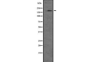 Western blot analysis of NRK expression in A549 cell line lysate ;,The lane on the left is treated with the antigen-specific peptide. (NRK anticorps  (N-Term))