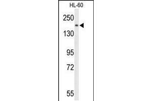 Western blot analysis of PLCB1 Antibody in HL-60 cell line lysates (35ug/lane) (Phospholipase C beta 1 anticorps  (C-Term))