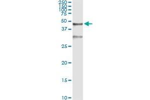 Immunoprecipitation of SERPINB3 transfected lysate using mouse monoclonal anti-SERPINB3 and Protein A Magnetic Bead (SERPINB3 (Humain) IP-WB Antibody Pair)