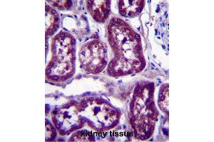 Immunohistochemistry (IHC) image for anti-Dihydropyrimidinase (DPYS) antibody (ABIN2997327) (DPYS anticorps)