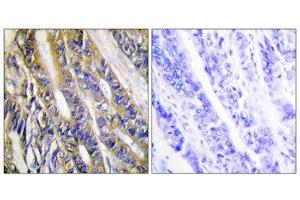 Immunohistochemistry (IHC) image for anti-Diacylglycerol Kinase, eta (DGKH) (Internal Region) antibody (ABIN1849746) (DGKH anticorps  (Internal Region))