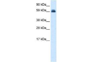 Western Blot showing ZNF499 antibody used at a concentration of 1-2 ug/ml to detect its target protein. (ZBTB45 anticorps  (Middle Region))