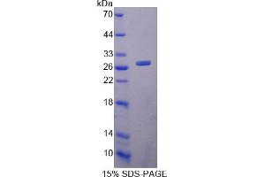 Image no. 1 for Integrin alpha-L (ITGAL) (AA 788-1004) protein (His tag) (ABIN6237737) (ITGAL Protein (AA 788-1004) (His tag))