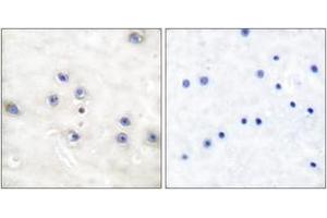 Immunohistochemistry analysis of paraffin-embedded human brain tissue, using COT (Ab-290) Antibody. (CROT anticorps  (AA 256-305))