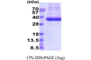 SDS-PAGE (SDS) image for Plasminogen Activator, Tissue (PLAT) (AA 36-310) protein (His tag) (ABIN6388054) (PLAT Protein (AA 36-310) (His tag))