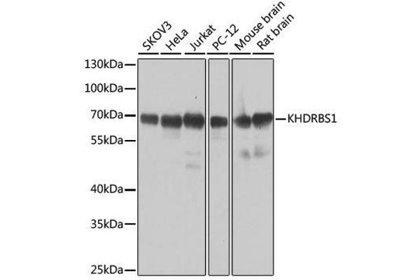 KHDRBS1 anticorps  (C-Term)