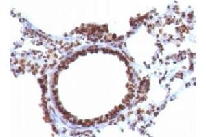 Immunohistochemistry (Formalin-fixed Paraffin-embedded Sections) (IHC (fp)) image for anti-Nuclear Marker antibody (ABIN3026799)