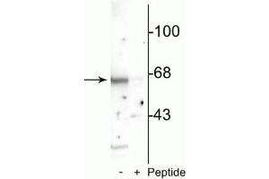 Western blot of rat cortical lysate showing specific immunolabeling of the ~65 kDa Munc-18 protein phosphorylated at Ser513 in the first lane (-). (STXBP2 anticorps  (pSer513))