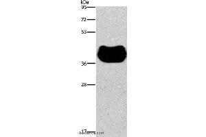 Western blot analysis of Human fetal muscle tissue, using HRH2 Polyclonal Antibody at dilution of 1:300 (HRH2 anticorps)
