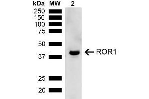 Western blot analysis of Rat Kidney showing detection of ~43 kDa ROR1 protein using Rabbit Anti-ROR1 Polyclonal Antibody (ABIN5667786). (ROR1 anticorps  (AA 200-300) (Atto 594))