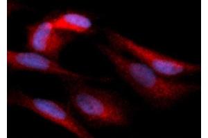 Immunofluorescence (IF) image for anti-Hexokinase 1 (HK1) (AA 1-917) antibody (PE) (ABIN5567562) (Hexokinase 1 anticorps  (AA 1-917) (PE))