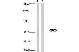 Western blot analysis of extracts from HeLa cells treated with UV, using CREB (Ab-129/133) antibody (#B7053). (CREB1 anticorps  (Ser129, Ser133))