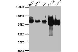 Western Blot Positive WB detected in: Hela whole cell lysate, A375 whole cell lysate, HEK293 whole cell lysate, Rat Brain whole cell lysate, Mouse Brain whole cell lysate All lanes: Amyloid beta A4 antibody at 1:1000 Secondary Goat polyclonal to rabbit IgG at 1/50000 dilution Predicted band size: 87, 35, 77, 79, 79, 81, 83, 85, 86, 73, 85 kDa Observed band size: 100 kDa (Recombinant APP anticorps)